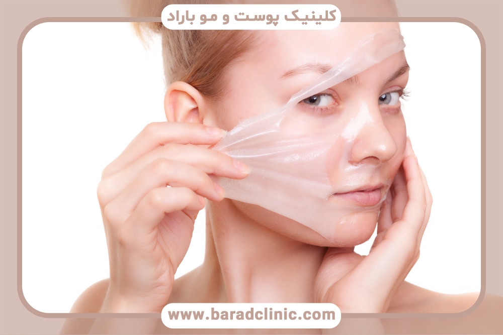 چیزهایی که باید درباره لایه‌برداری شیمیایی TCA برای جوان‌سازی بدانید