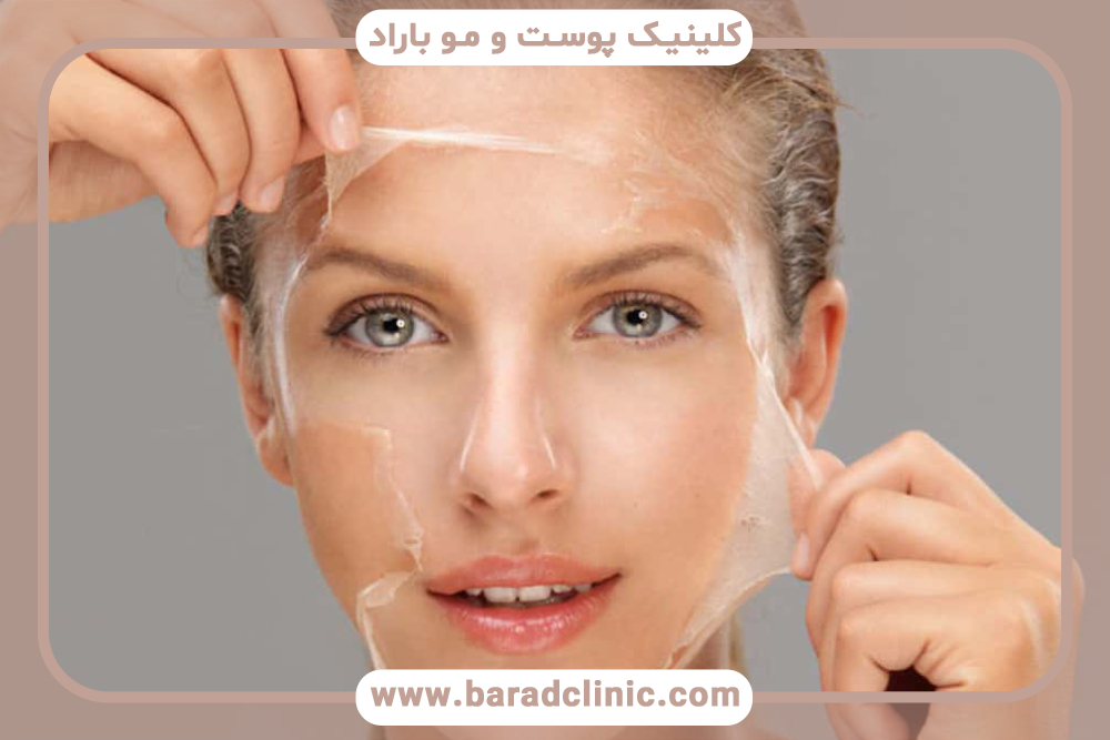 آشنایی با لایه‌برداری پوست صورت و جراحی لیزر