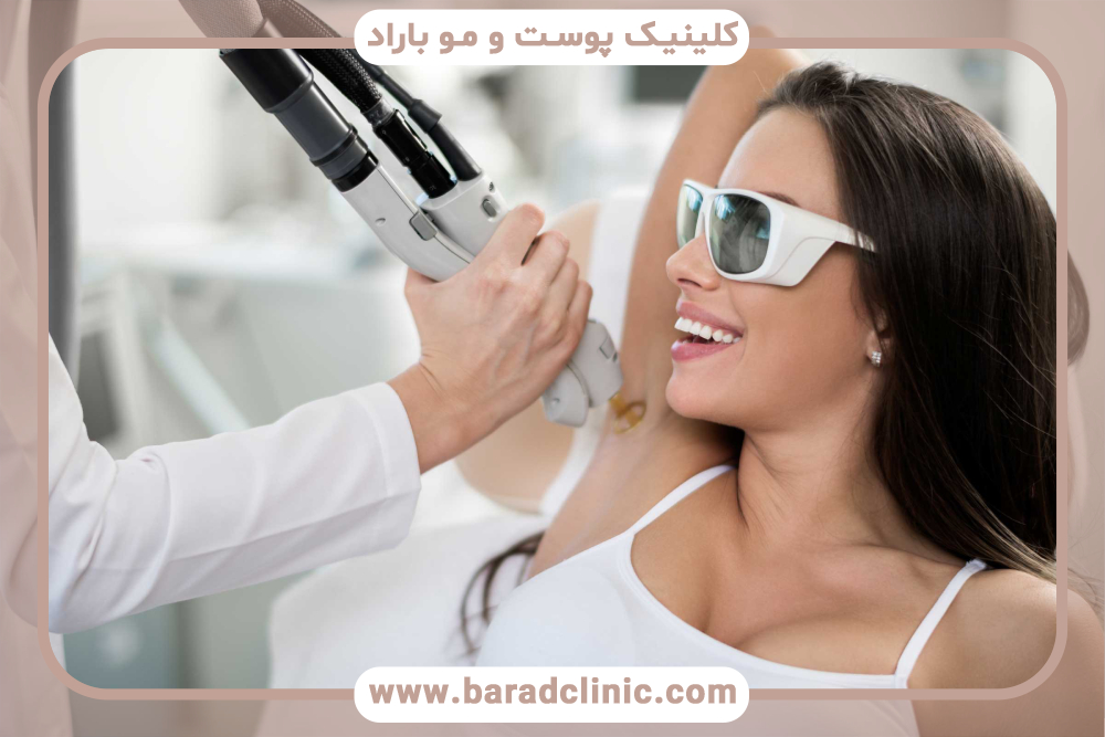 پیش از لیزر موهای زائد