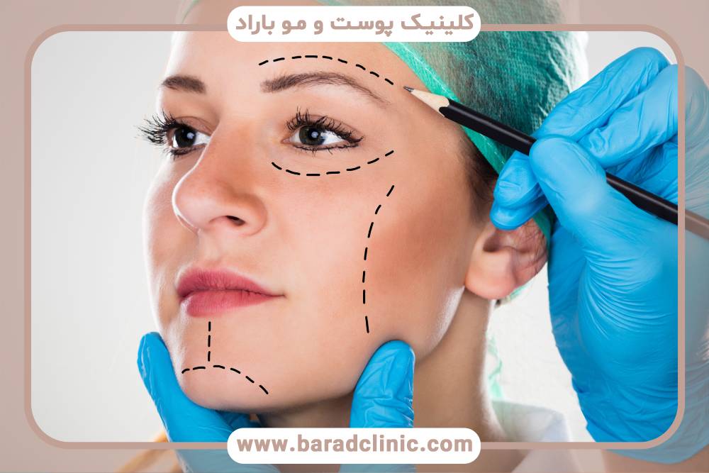 تزریق نانوفت پوست برای جوانسازی و افزایش حجم همزمان