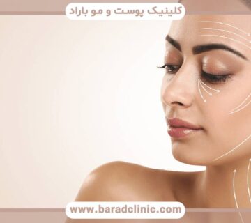 ریکاوری لیفت گردن: نکاتی برای یک سفر درمانی راحت