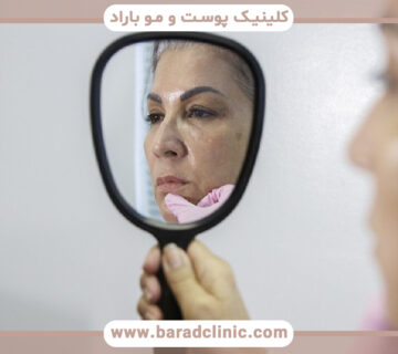 فیلرهای ضد پیری