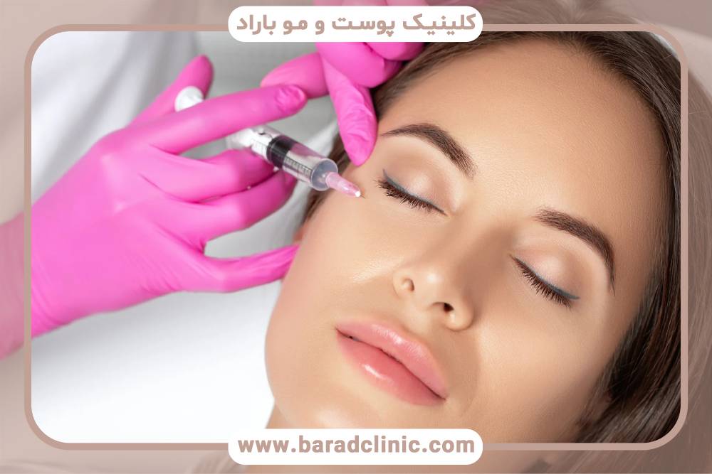 فیلرهای پوستی