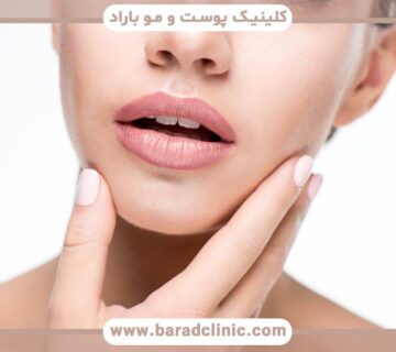 نکاتی برای پیشگیری و درمان افتادگی جولها