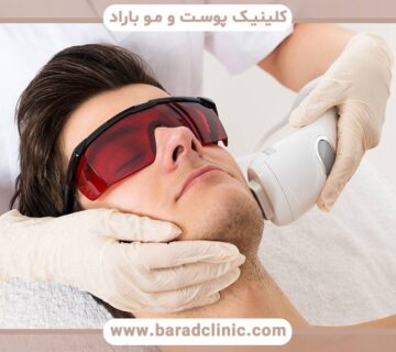 زمان جلسات لیزر موهای زائد چقدر طول میکشد؟