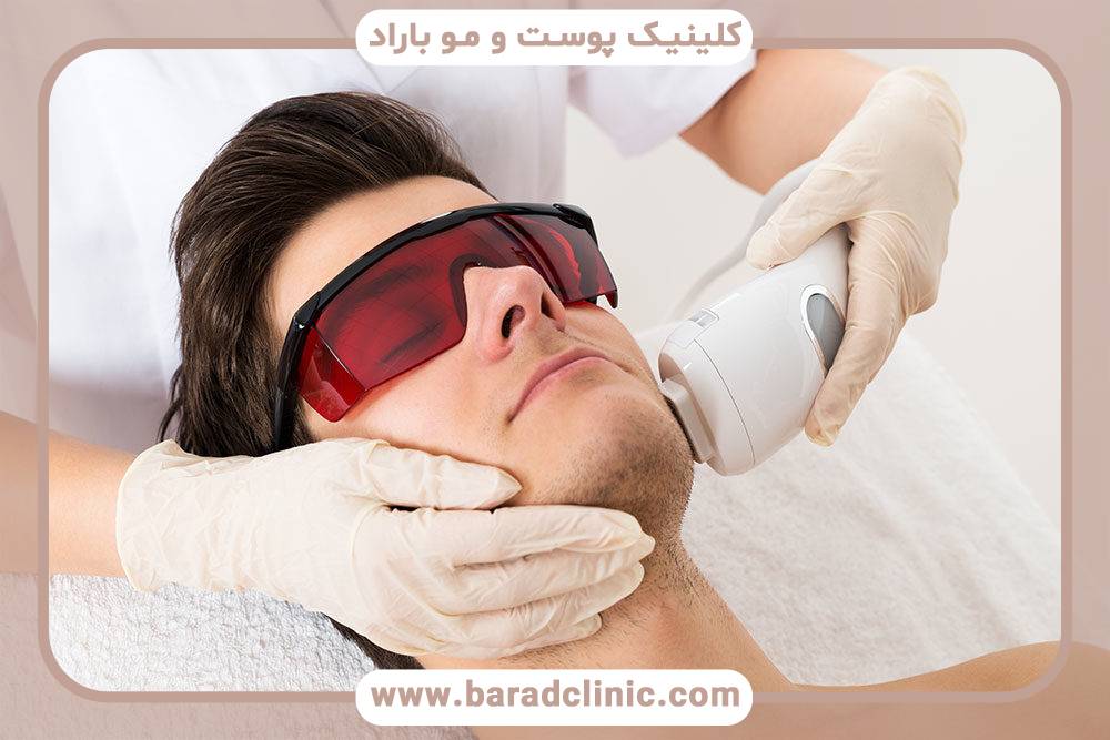 زمان جلسات لیزر موهای زائد چقدر طول می‌کشد؟