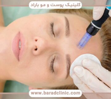 بررسی چند مزیت درمان میکرونیدلینگ