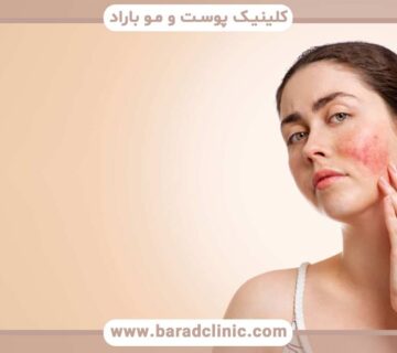 شایع ترین مشکلات پوستی و نحوه درمان آنها