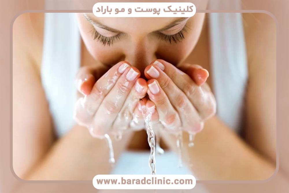 شستن صورت بعد از تزریق ژل