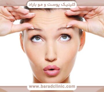 بیبی بوتاکس چیست؟ هر آنچه لازم است بدانید