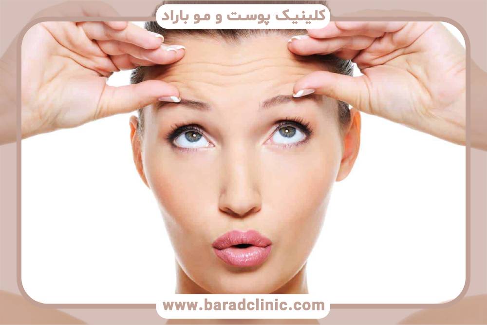 بیبی بوتاکس چیست؟ هر آنچه لازم است بدانید