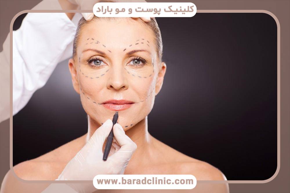 بهترین سن برای لیفت صورت چه سنی است؟