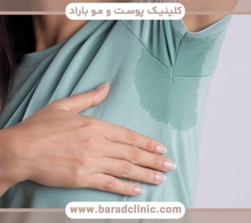 بیماری هایپرهیدروزیس چیست و راه درمان آن چیست؟