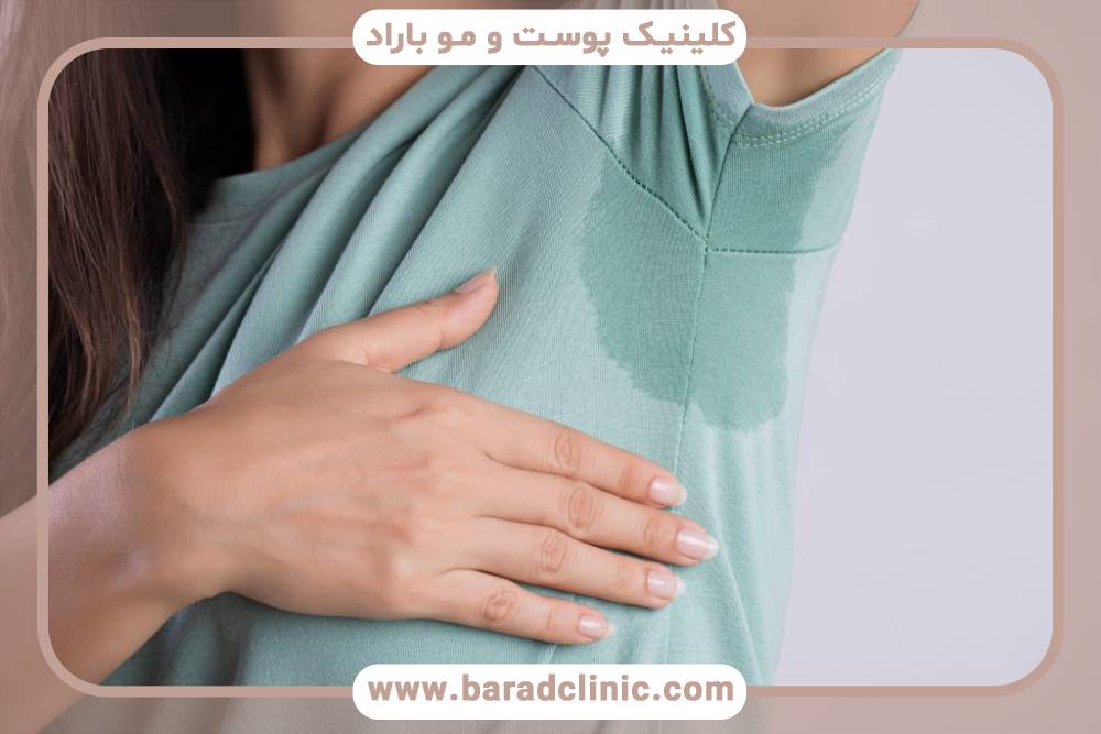 بیماری هایپرهیدروزیس چیست و راه درمان آن چیست؟