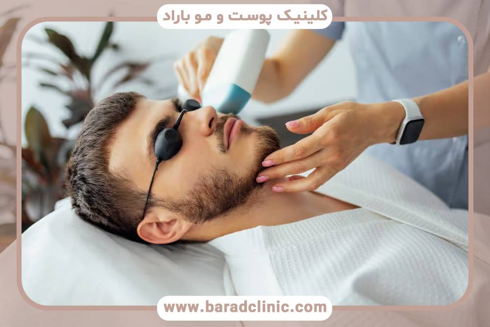 زمان جلسات لیزر موهای زائد