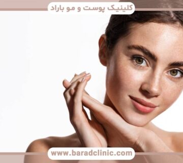 آنچه باید در مورد لیفت چشم روباهی بدانید