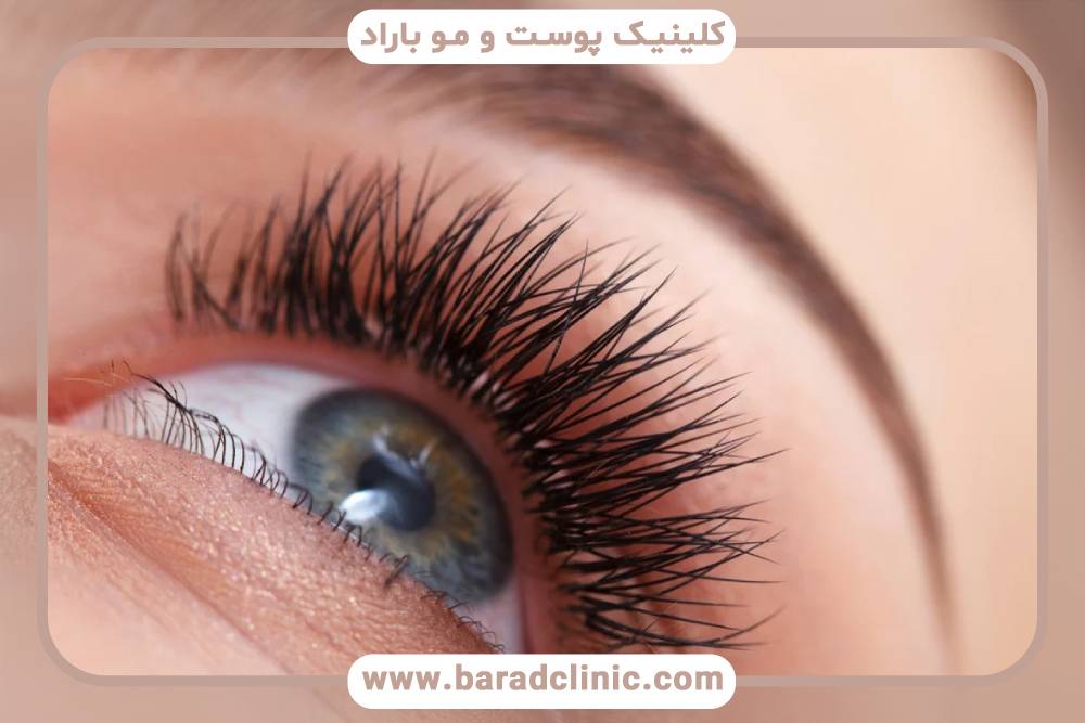رشد مژه