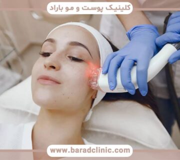 نکات ریکاوری بعد از بازسازی پوست با لیزر