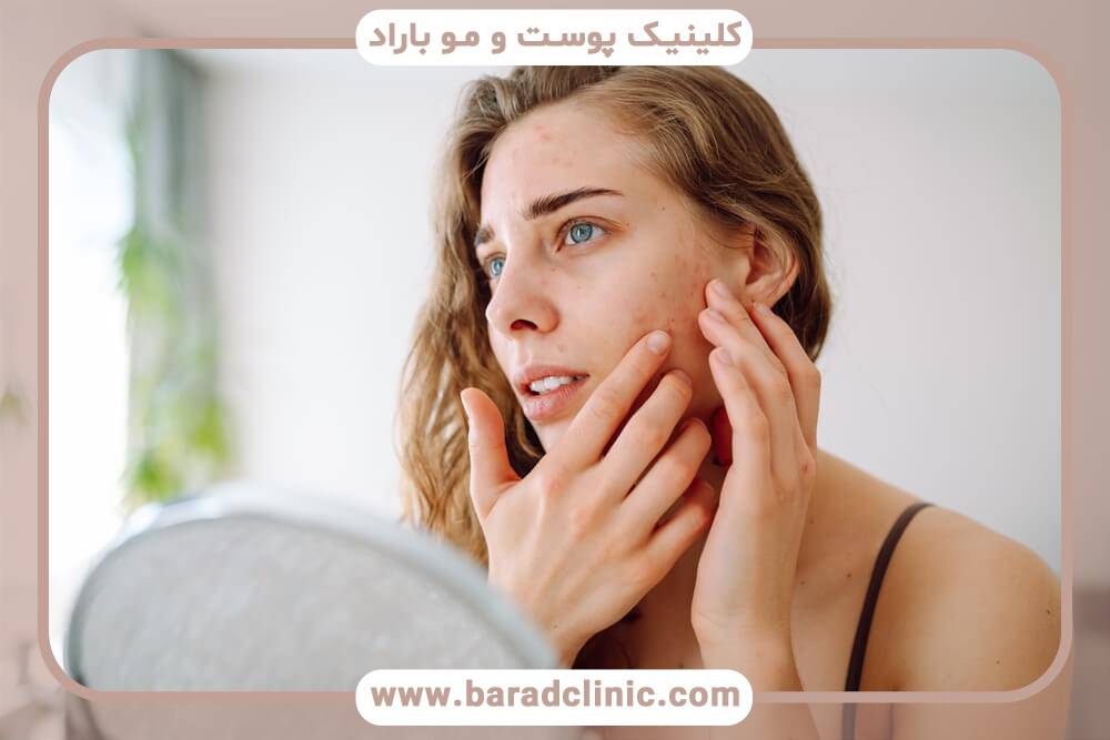 پوست آسیب دیده از خورشید