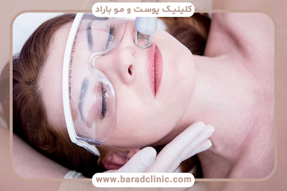 Choosing a laser device