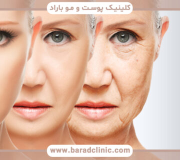 جوانسازی صورت