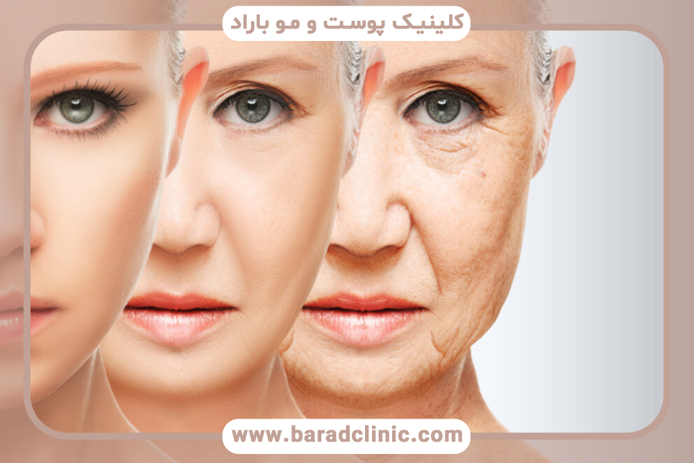 جوان‌سازی صورت