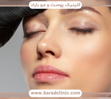 مروری بر بوتاکس و درمانهای تزریقی جایگزین