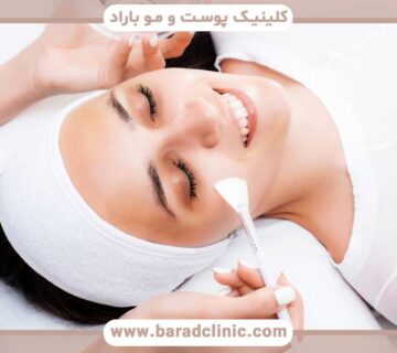 لایهبرداری شیمیایی پوست