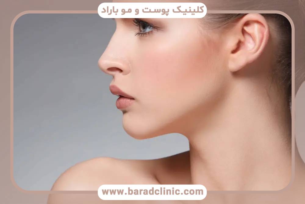 چرا مردان بیشتر از زاویه سازی چانه استفاده می کنند؟