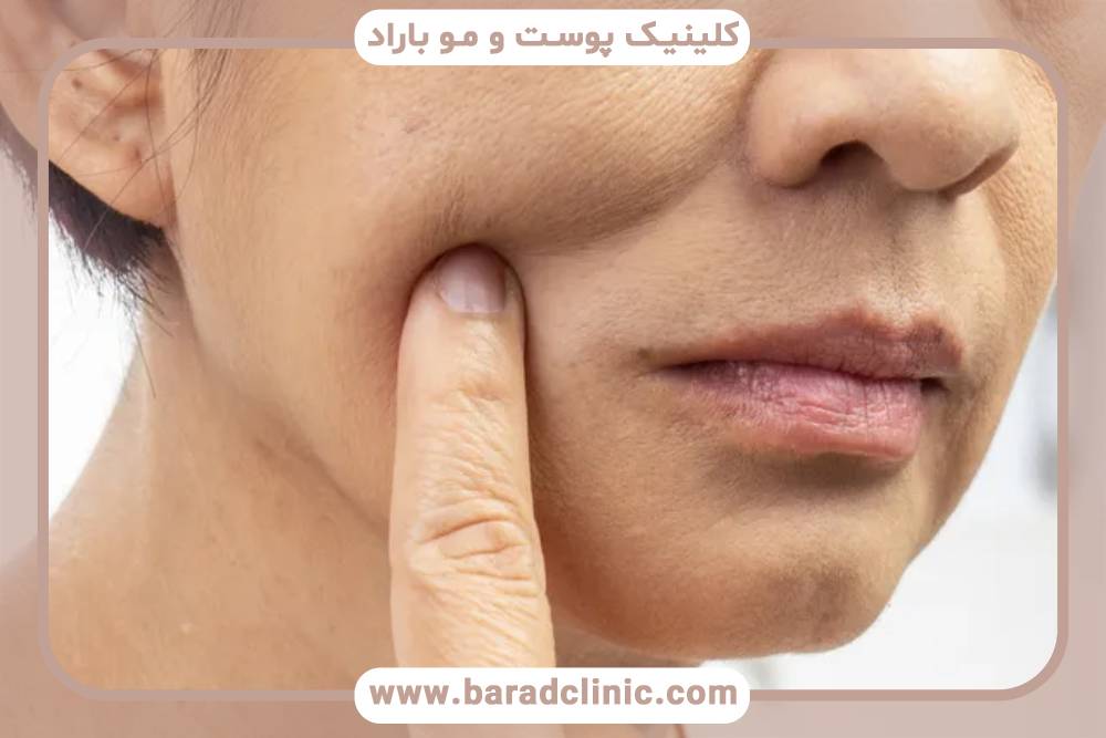 کاهش وزن سریع