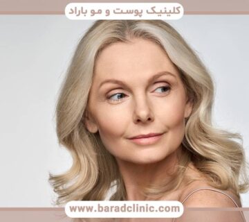 درمان های زیبایی برای زنان بالای 40 سال