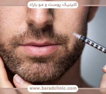 جراحی پلاستیک برای مردان