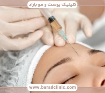 زمان مناسب برای تزریق بوتاکس چه زمانی است؟