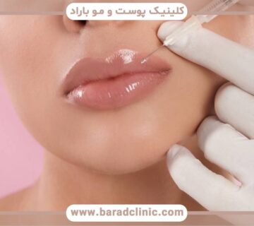 گزینههای اصلاحی فیلر لب خراب چیست؟
