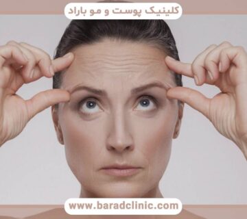 کاهش خطوط ریز صورت و چین و چروک