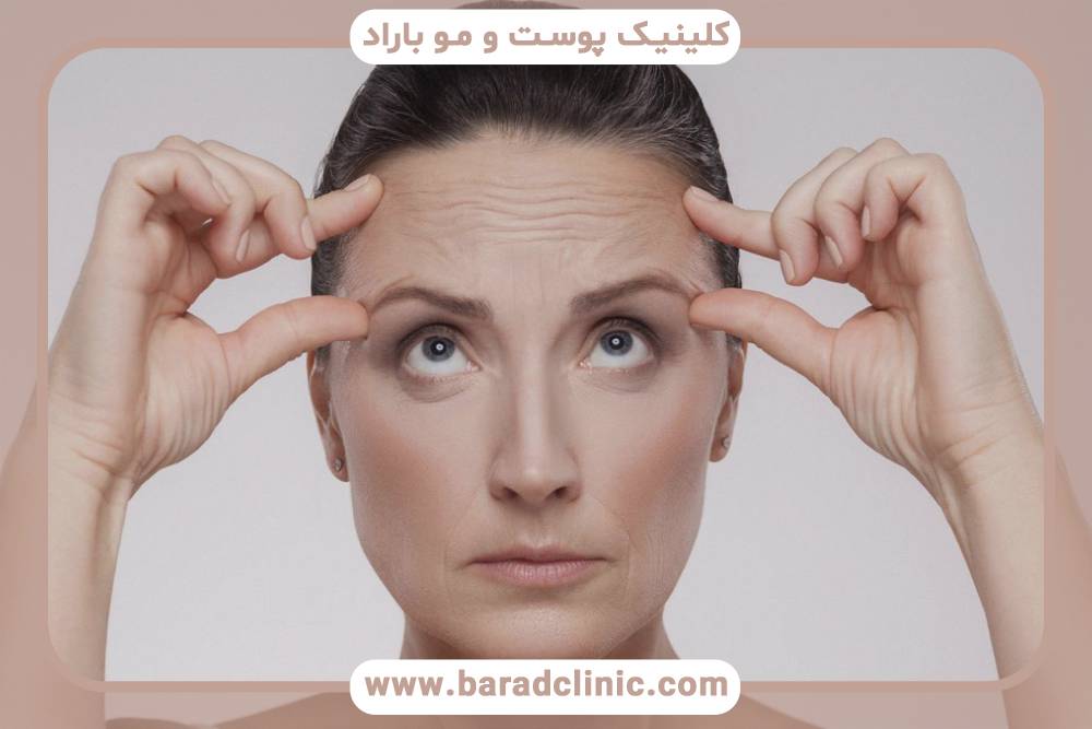 کاهش خطوط ریز صورت و چین و چروک