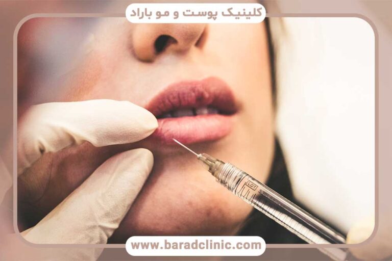 Lip gel discharge