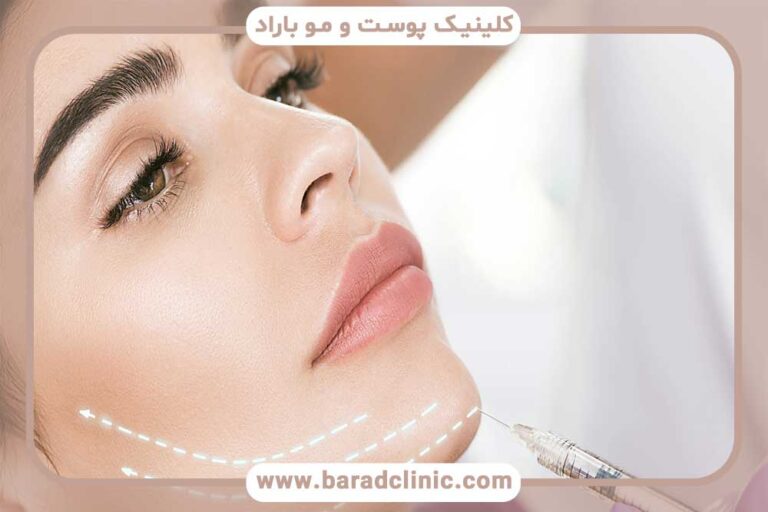 Face contouring