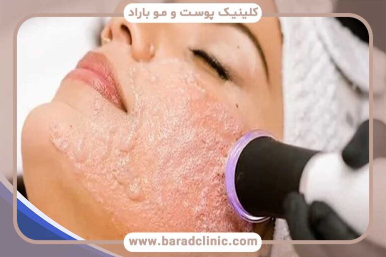 pelagen therapy