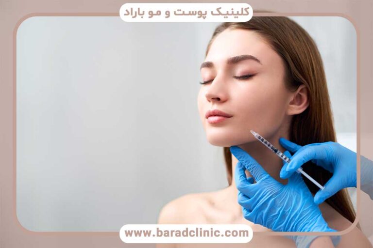 Chin filler