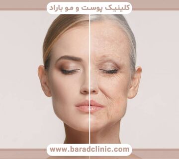 کاهش حجم گونه_ها