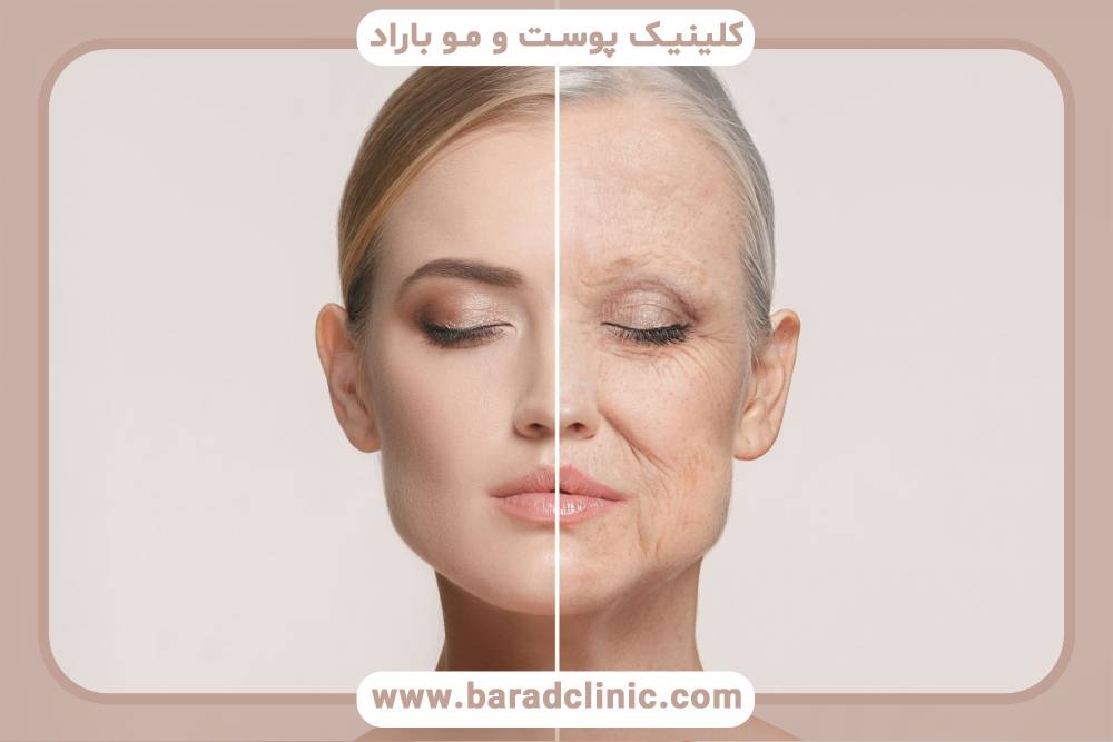 کاهش حجم گونه_ها