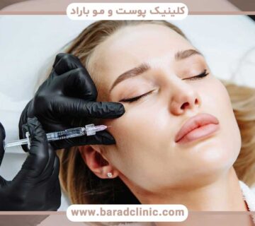 Necessary measures before filler injection