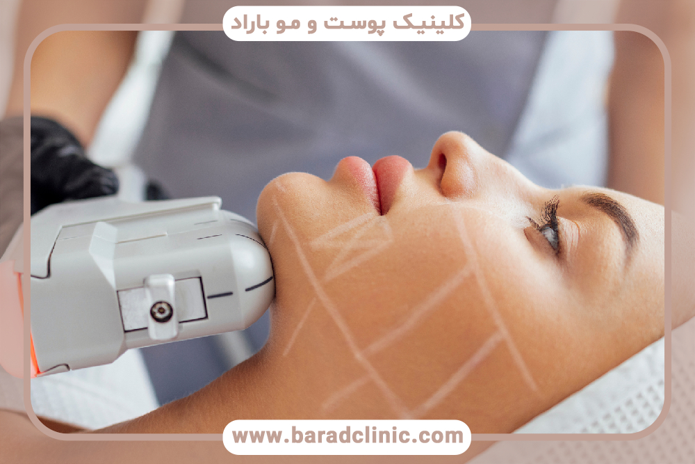 کاربرد هایفوتراپی برای صورت چیست؟