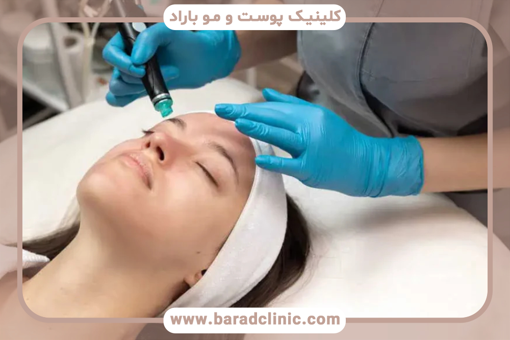 هیدروفیشیال پوست صورت