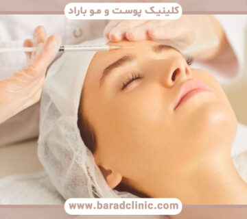 مزوژل پروسترولین ضد لک