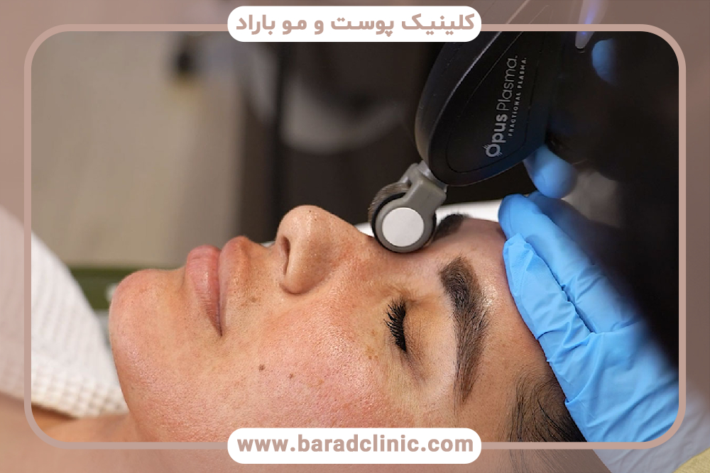 پلاسما فرکشنال