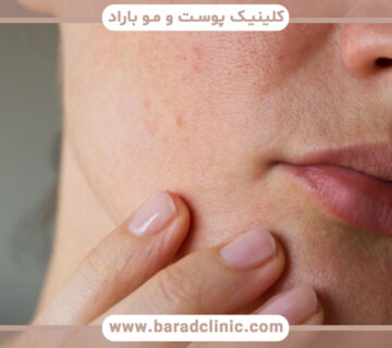 بهترین راهها برای مراقبت از پوست خشک چیست؟