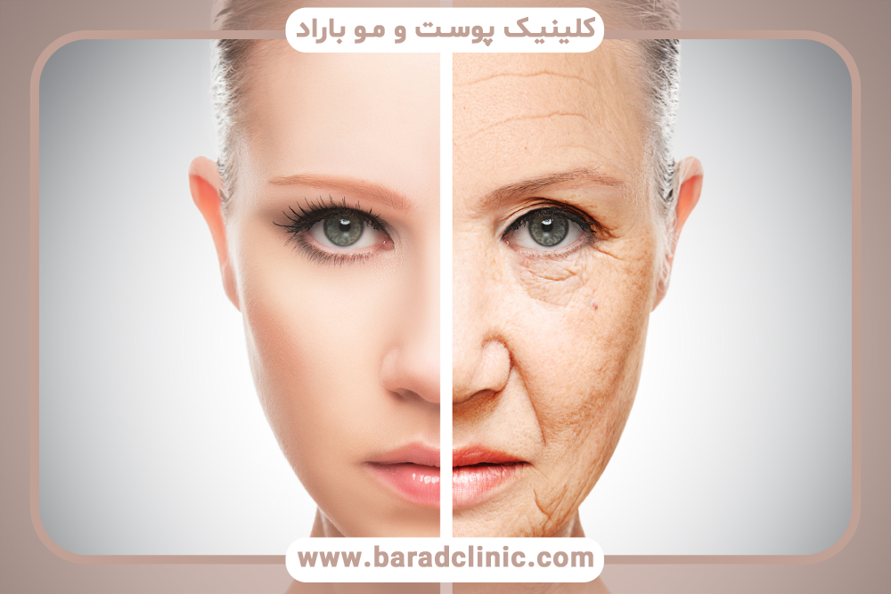 درمان سفت کننده پوست