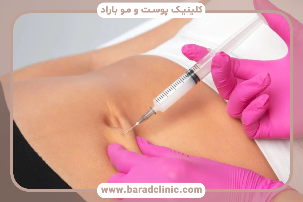 تزریق چربی به باسن